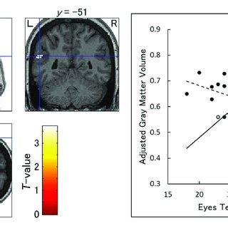 Brain Regions Showing A Significant Interaction Between Group And