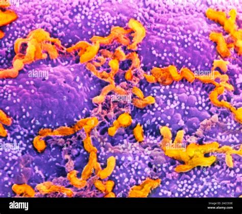 Coloured Scanning Electron Micrograph Of The Bacterium Helicobacter