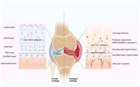 Ijms Free Full Text Cartilage Related Collagens In Osteoarthritis