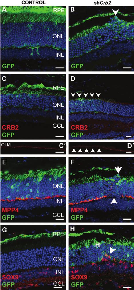 Photoreceptor Specific Knockdown Of Crb2 Using Aav2 5 Cmv Gfp H1 Download Scientific