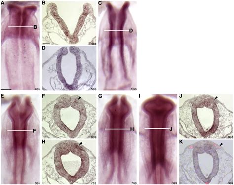 Acegi Whole Mount In Situ Hybridization For Annexin A6 Followed