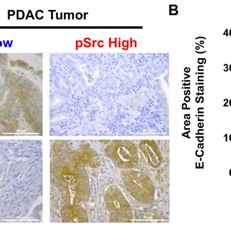 Inverse Correlation Between Src Kinase Activation And E Cadherin Levels Download Scientific