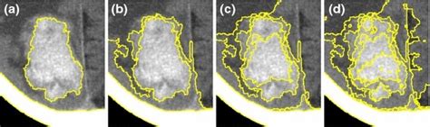 Segmentations Of Srm On A Synthetic Grayscale Image For Various Values