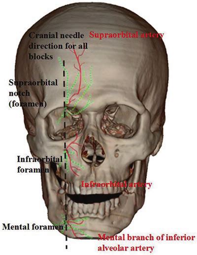 9 Blockade Of The Terminal Sensory Branches Of The Trigeminal Nerve