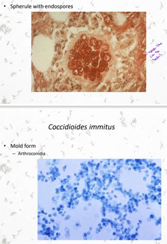 Micro Exam 3 Lecture 2 Fungal Respiratory Infections Flashcards