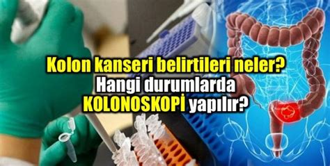 Kolon Kanseri Belirtileri Neler Kolonoskopi Nedir Ndigo Dergisi