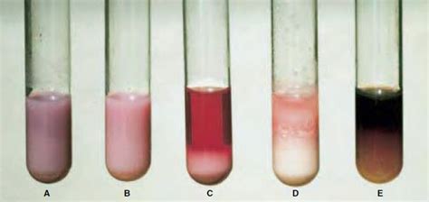 Avibert Litmus Milk Reactions Microbiological Applications