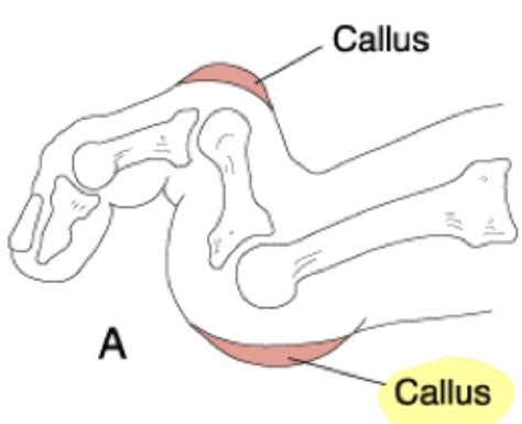 Foot Ankle Flashcards Quizlet