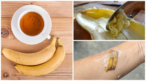 5 Formas De Utilizar Las Cáscaras De Banana Como Remedio Natural Mejor Con Salud