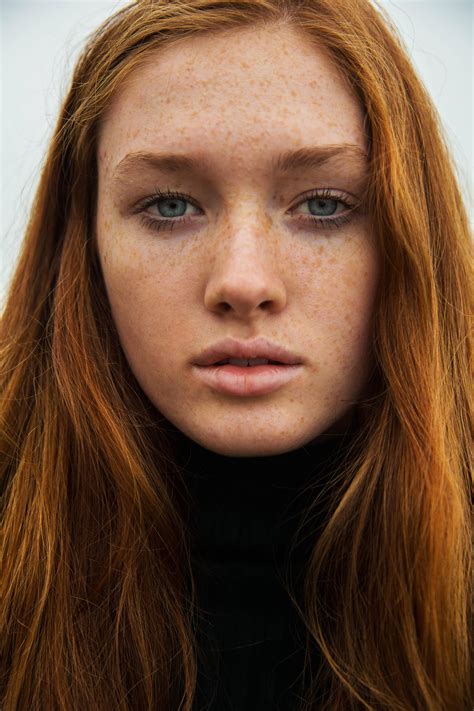 Sarah Gullixson Black Hair And Freckles Freckles Girl Red Hair Freckles