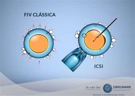 Fiv Cl Ssica X Fiv Icsi Dr Jo O Dias