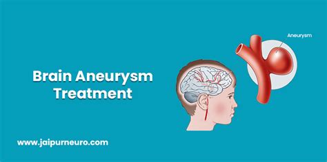 Brain Aneurysm Treatment in Jaipur by Dr. Vikram Bohra | JaipurNeuro