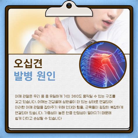 오십견 증상 자가진단 치료 오른쪽 왼쪽 어깨 통증의 원인 네이버 포스트