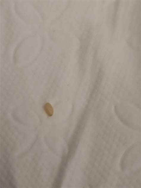 Is this a parasite egg? : r/DiagnoseMe