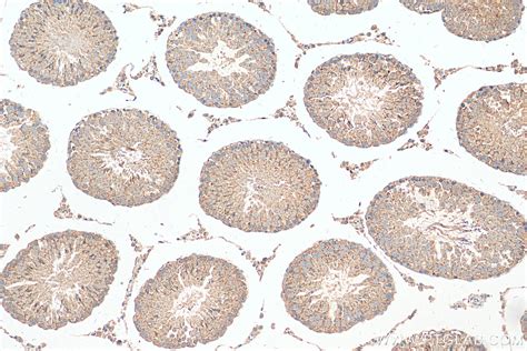 Nnos Antibody Ap Proteintech