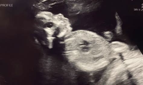 Lets See Our Week Ultrasounds July Babies Forums What