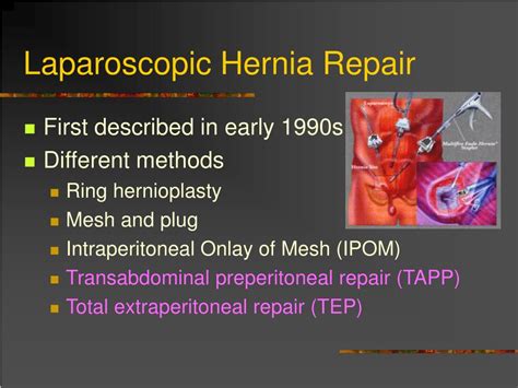 Ppt Repair Of Inguinal Hernia Open Or Laparoscopic Powerpoint