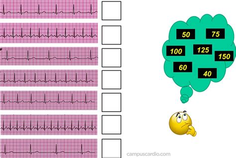 Calcula La Frecuencia Cardíaca En Estas Tiras De Ritmo