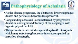 Dysphagia And Achalasia Undergraduate Lecture Ppt