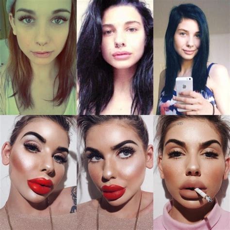 Botched Surgeries That Went Horribly Wrong In Plastic Surgery