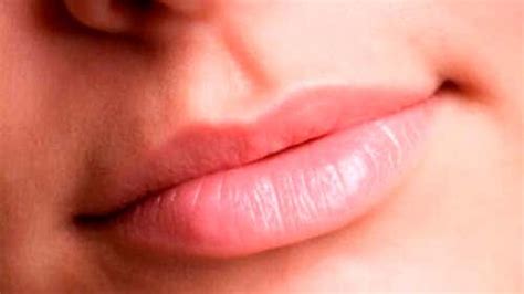 ¿por Qué Se Resecan Los Labios Mejor Con Salud