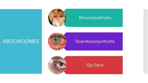 Conjuntivitis Al Rgica Ppt Descarga Gratuita