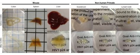 Rust Colored Sputum