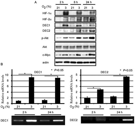 Involvement Of C Myc In The Proliferation Of Mcf Human Breast Cancer