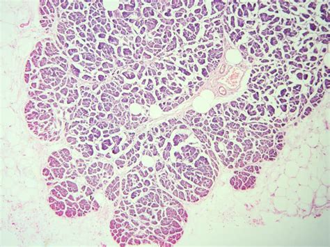 Histology Of Human Pancreas Tissue Stock Photo Image Of Squamous