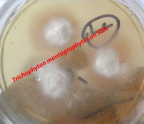 Trichophyton mentagrophytes: Introduction, Morphology, Pathogenecity