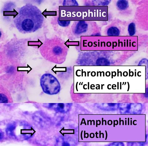 Hematoxylin And Eosin Staining A Really Easy Introduction