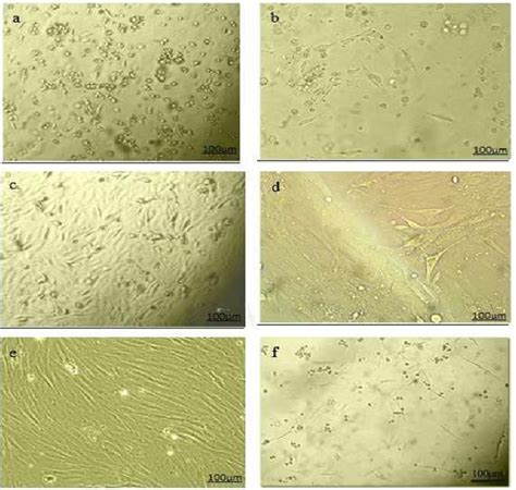 Cell Morphology Of Cultured ROT MSCs The Initial Adherent Cells