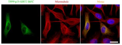 Localization Of The SIRT2 TPPP P25 Complex On The Microtubule Network