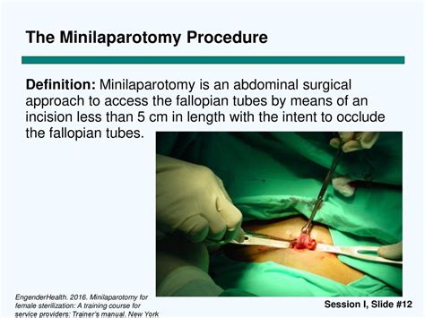 Session I Characteristics Of Tubal Ligation Female Sterilization