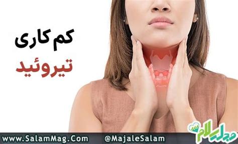 کم کاری تیروئید چیست و چه علائمی دارد؟ مجله پزشکی سلام