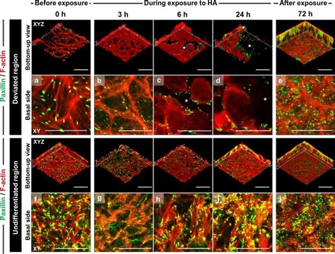 Focal Adhesion Reorganization Associated With Cytoskeletal Formation In