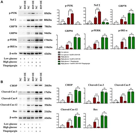 Lncrna H19 Inhibits Er Stress Induced Apoptosis And Improves Diabetic