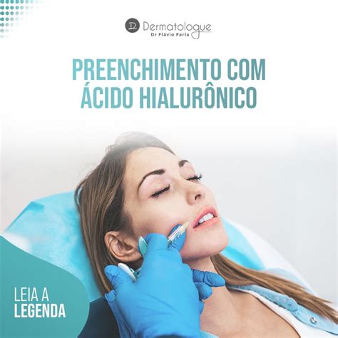 O Preenchimento Com Ácido Hialurônico é Realizado Por Meio De Uma