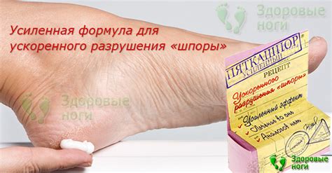 Купить крем Пяткашпор усиленный для лечения пяточной шпоры медицинской ...