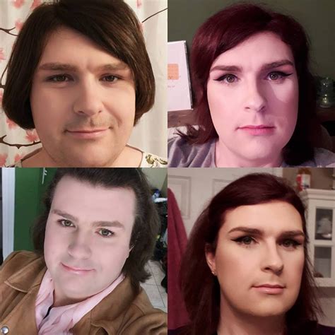 1 Year Difference And 7 Months Of Hrt Between Two Left Pics And 2 Right