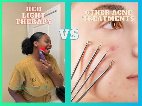 Dare To Compare Red Light Therapy Vs Other Acne Treatments What S