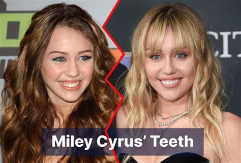 The Secret of Miley Cyrus’ Teeth | FindGlob