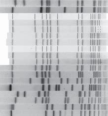 Pulsed Field Gel Electrophoresis Of MRSA Isolates From Cases Of