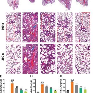 Effect Of DM On Histopathology And Cytokines A H E Staining Of Lung