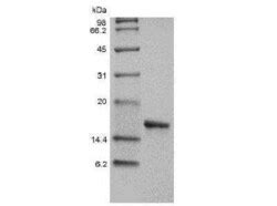 Novus Biologicals Recombinant Human Il Alpha Il F Protein Mg