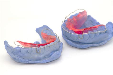 How Orthodontic Retainers Are Made Milnor Orthodontics