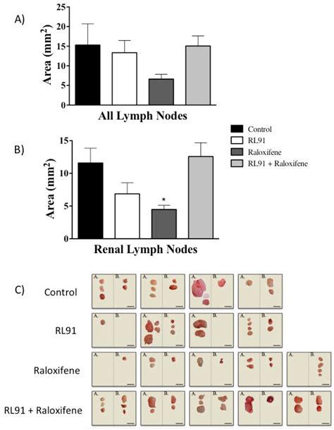 The Effect Of Raloxifene And Rl On Lymph Node Area In An Orthotopic