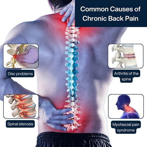 ways  treat chronic  pain  surgery pain management nyc