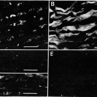 Immunofluorescence Microscopy Of Frozen Sections Of Human Aorta Cut