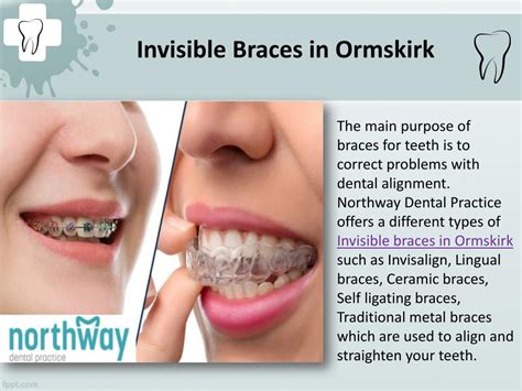 Ppt Invisible Braces In Ormskirk Powerpoint Presentation Free